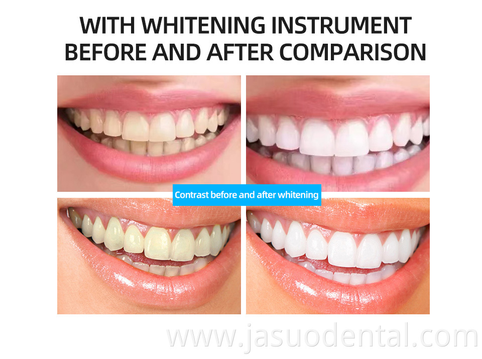 Dental Teeth Whitening Light
